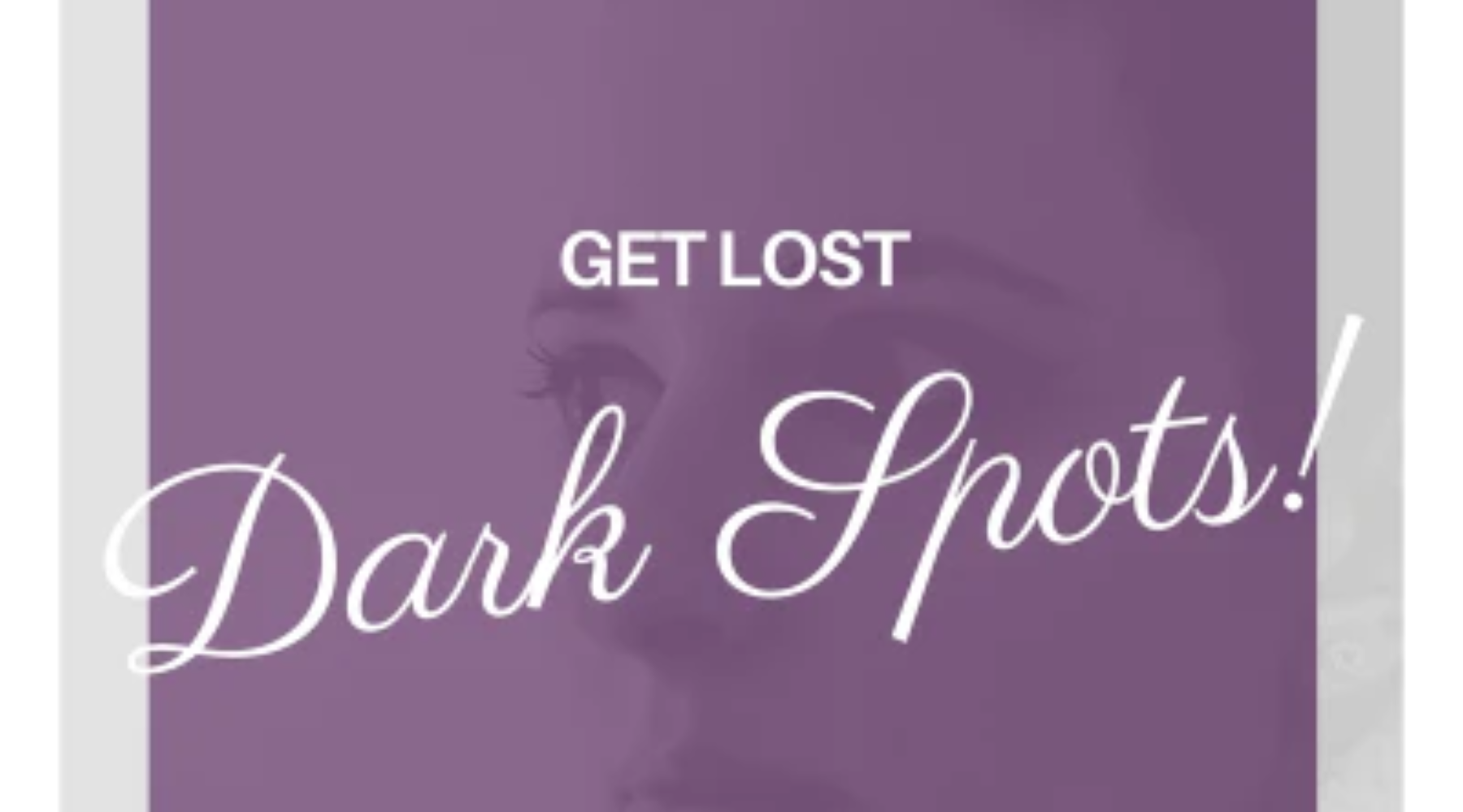 Be Gone! Dark Spots And Pigmentation